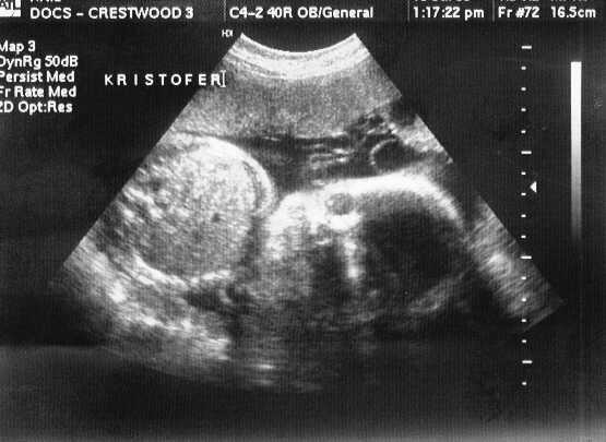 sono-0719-k1.JPG - 25.1 K